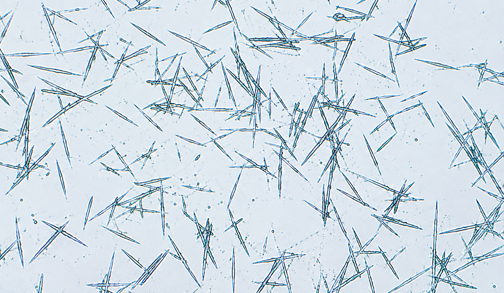 Microscopía: calcita (sarro)
