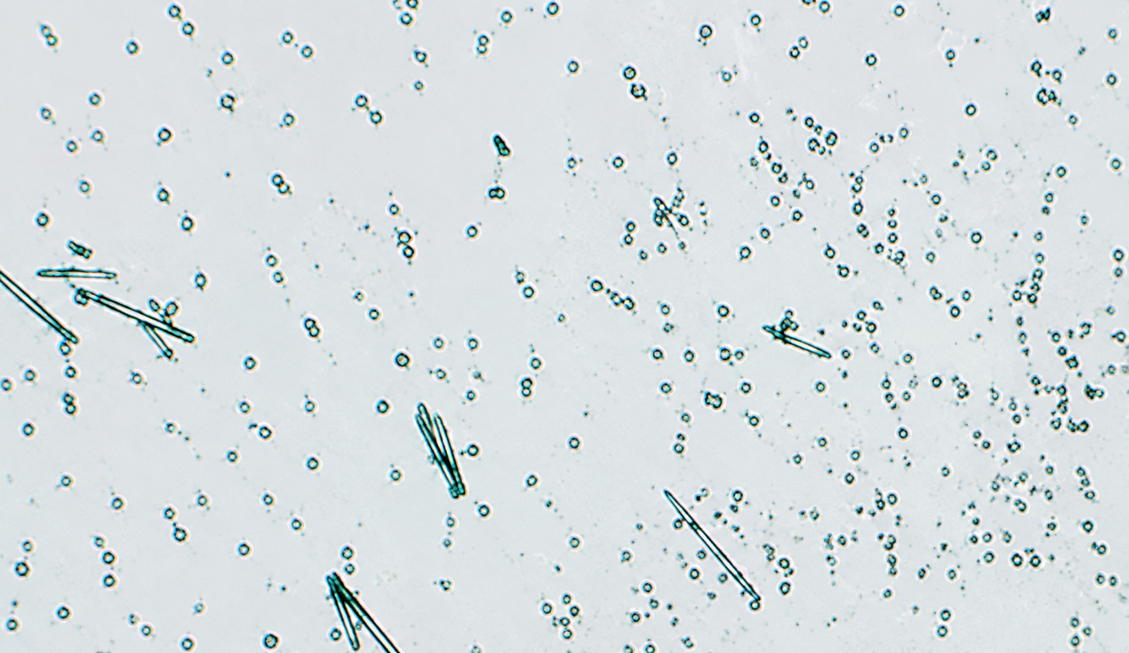 Microscopía: aragonita (sin sarro)